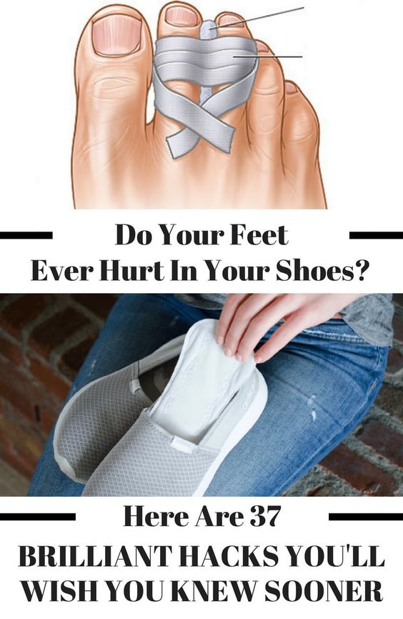 37 Shoe Hacks To Make Your Shoes More Comfortable – Tiger Feng
